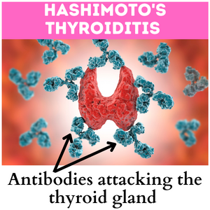 Homeopathic treatment for Hashimotos Thyroiditis